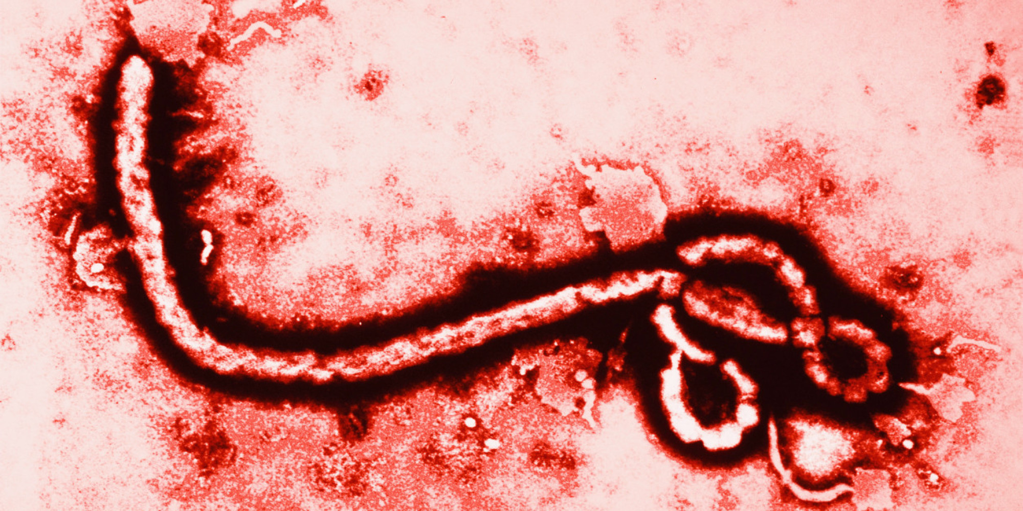 Kanak-kanak Warga Malaysia Dijangkiti Virus Ebola?